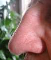 mans-nose