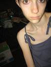 skinny-girl