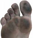 dirty-feet-1