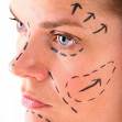 face lift