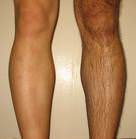 hairy legs 2