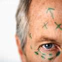 man plastic surgery