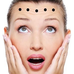 woman forehead